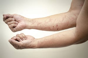 injury